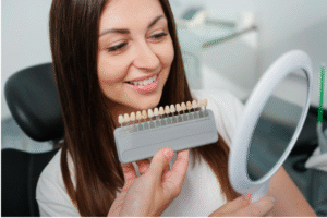 Dental Veneers: What to Expect Before, During, and After Treatment