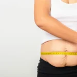 Physicians Weight Loss Centers Greensboro Nc: Common Questions, Risks, and Better Comparison Criteria
