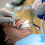 Why Wisdom Tooth Removal Is Best Handled By Oral Surgeons